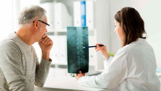 Osteoporosis: una epidemia silenciosa que en los hombres se diagnostica tarde