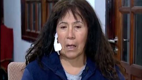 Pensé que me estaba muriendo: el dramático relato de la turista atacada con un ladrillazo camino a Ezeiza